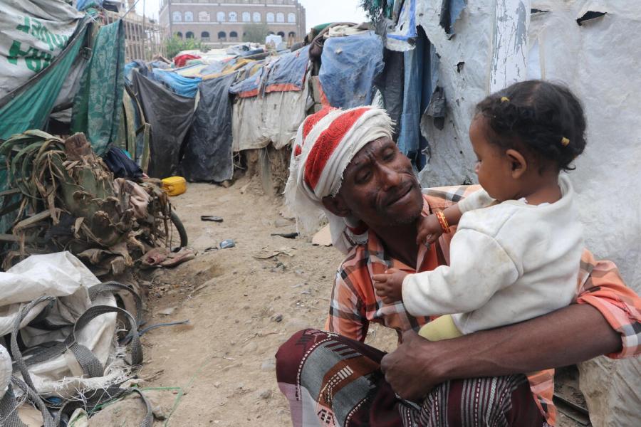 Sameer, 55, was displaced by the conflict in 2018. He and his family were uprooted from Taizz governorate and now live in Senan site in Al Dhihar district in Ibb governorate, Yemen. Their makeshift tent is made of pieces of plastic and cardboard and fails to meet minimum protection standards.