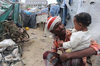 Sameer, 55, was displaced by the conflict in 2018. He and his family were uprooted from Taizz governorate and now live in Senan site in Al Dhihar district in Ibb governorate, Yemen. Their makeshift tent is made of pieces of plastic and cardboard and fails to meet minimum protection standards.
